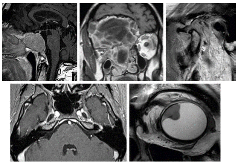 Head and Neck MRI 2027