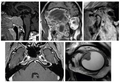 Head and Neck MRI 2027