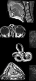 Head and Neck MRI 2026 - Fully booked