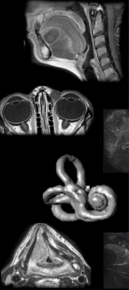 Head and Neck MRI 2026 - Fully booked