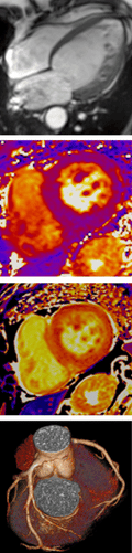 Cardiovascular MRI + CT 2027