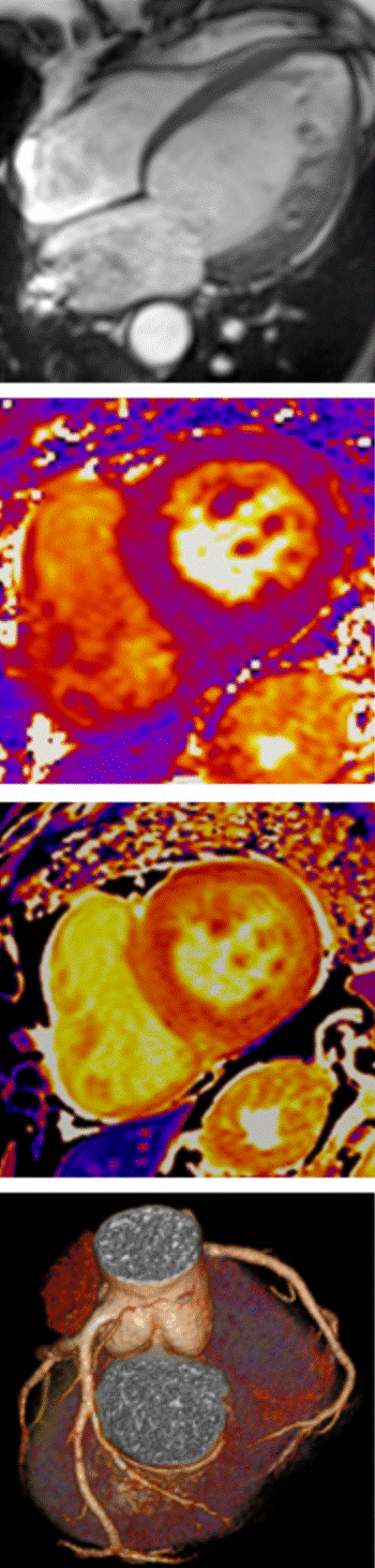 Cardiovascular MRI + CT 2027