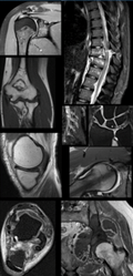 Musculoskeletal MRI (comprehensive course) 2026