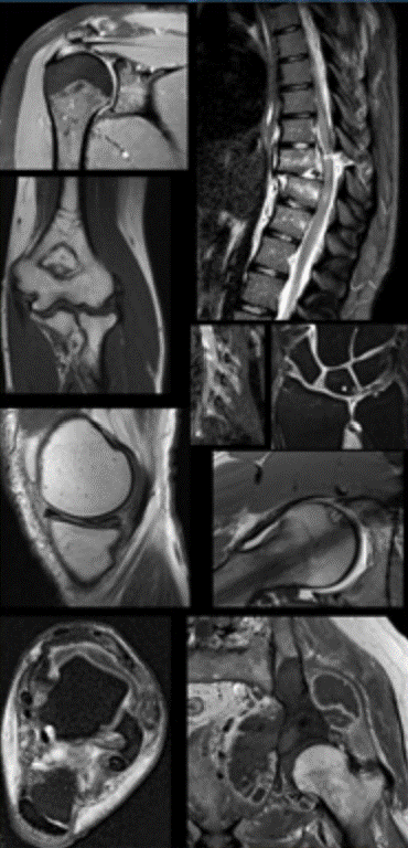 Musculoskeletal MRI (comprehensive course) 2026