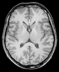Neuro MRI 2027